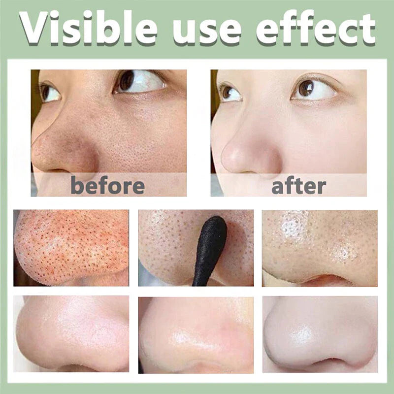 Máscara Chá Verde Remover de Cravos Anti-Acne Hidratante Beleza Pele Facial Clean Face Clareador Mask Stick FEBELLA BEST